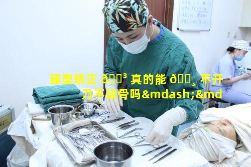 腿型矫正 🐳 真的能 🌸 不开刀不动骨吗——型腿矫正专科医院探秘